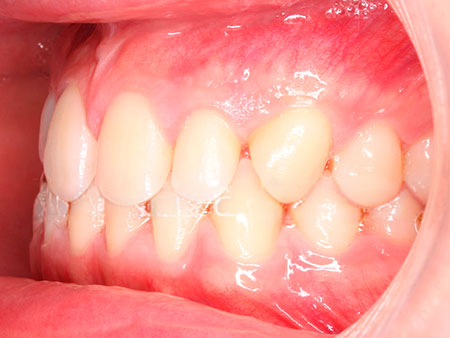 diego-v-izquierda-antes