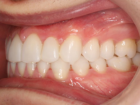 diego-v-izquierda-despues